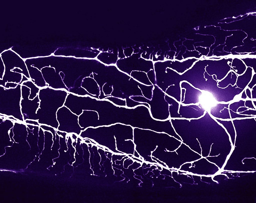 Black background, bright purple light. Lighting: Mechanosensory neuron of an aging nematode