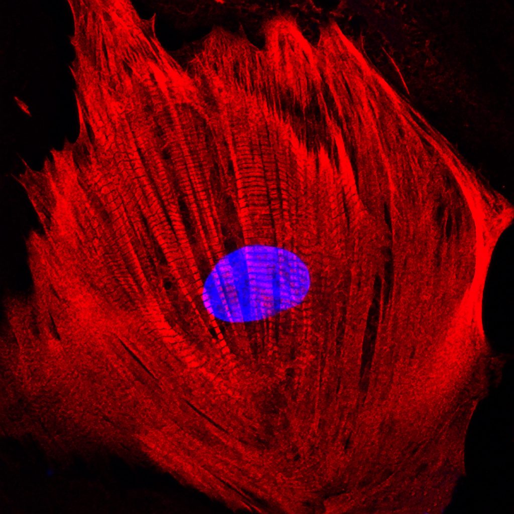 Red and black. Thistle: A human heart cell differentiated from induced pluripotent stem cells