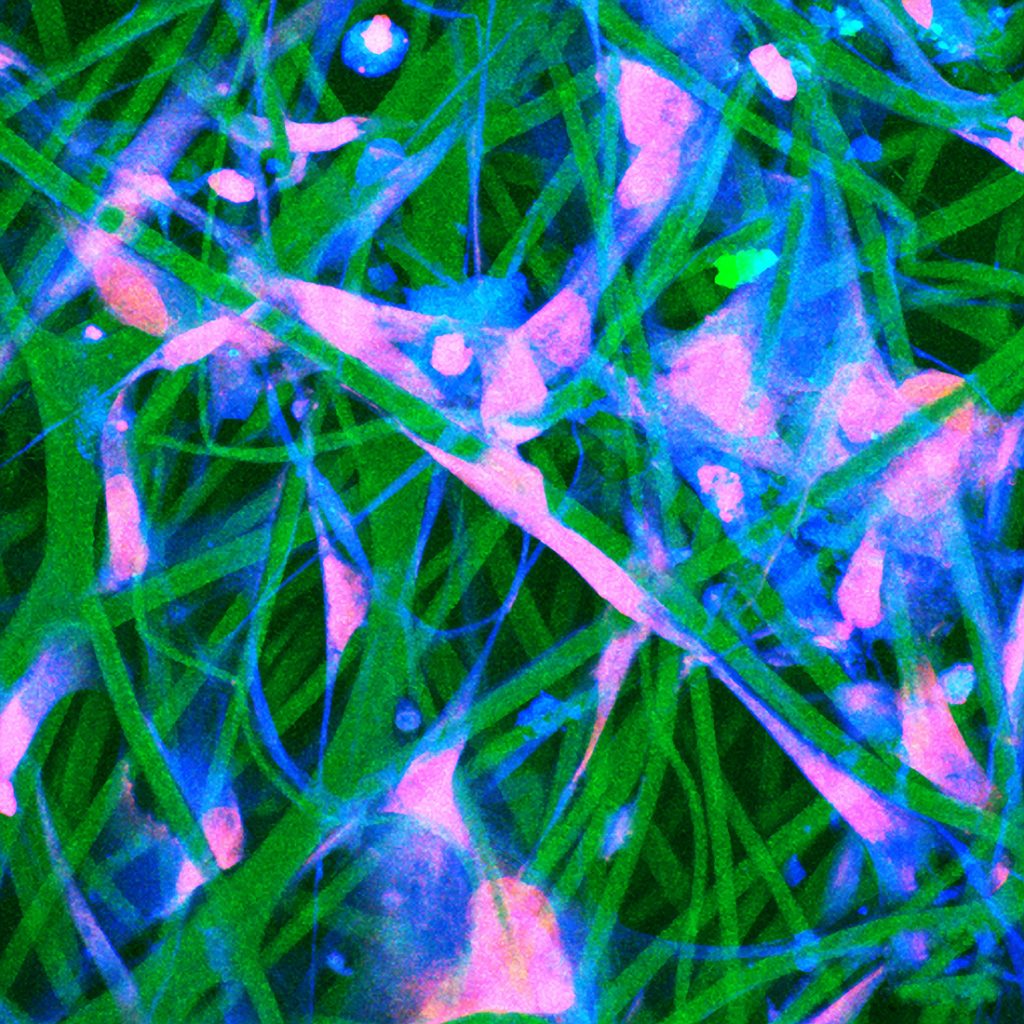 Purble and green / Mesenchymal stem cells on a nanofibrous scaffold