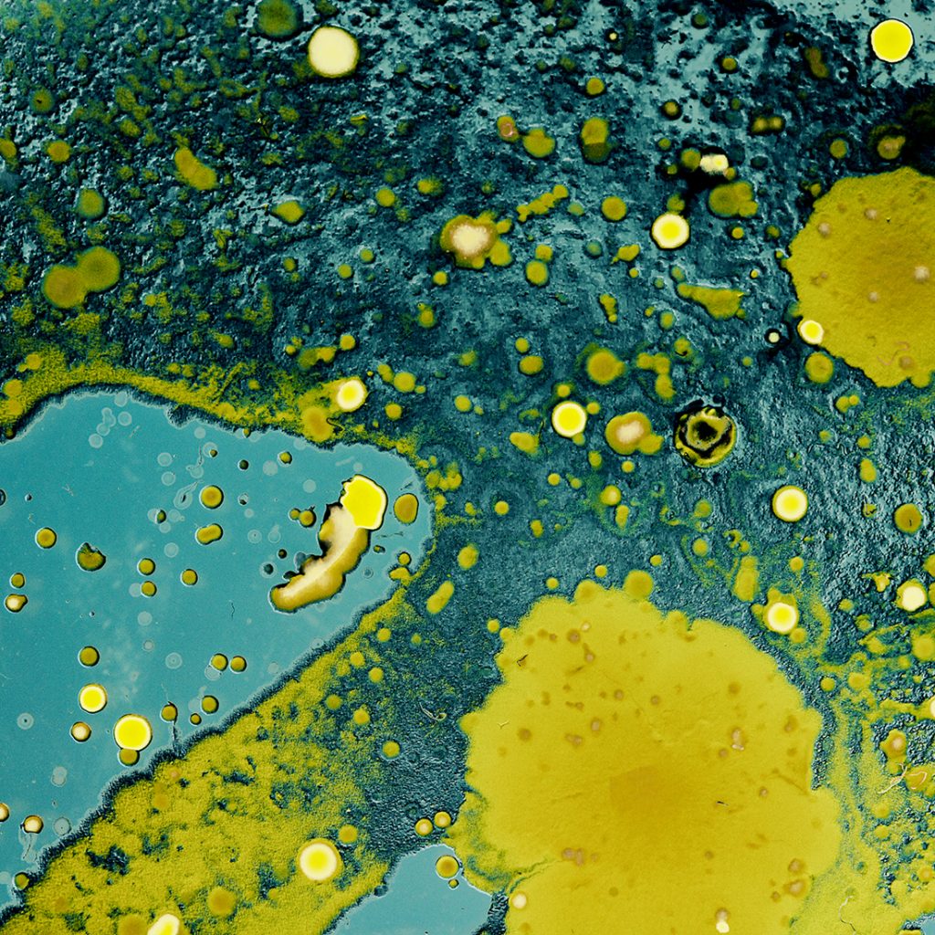 Macro photograph of a skin sample that looks like yellow islands of various sizes on a green-blue lake