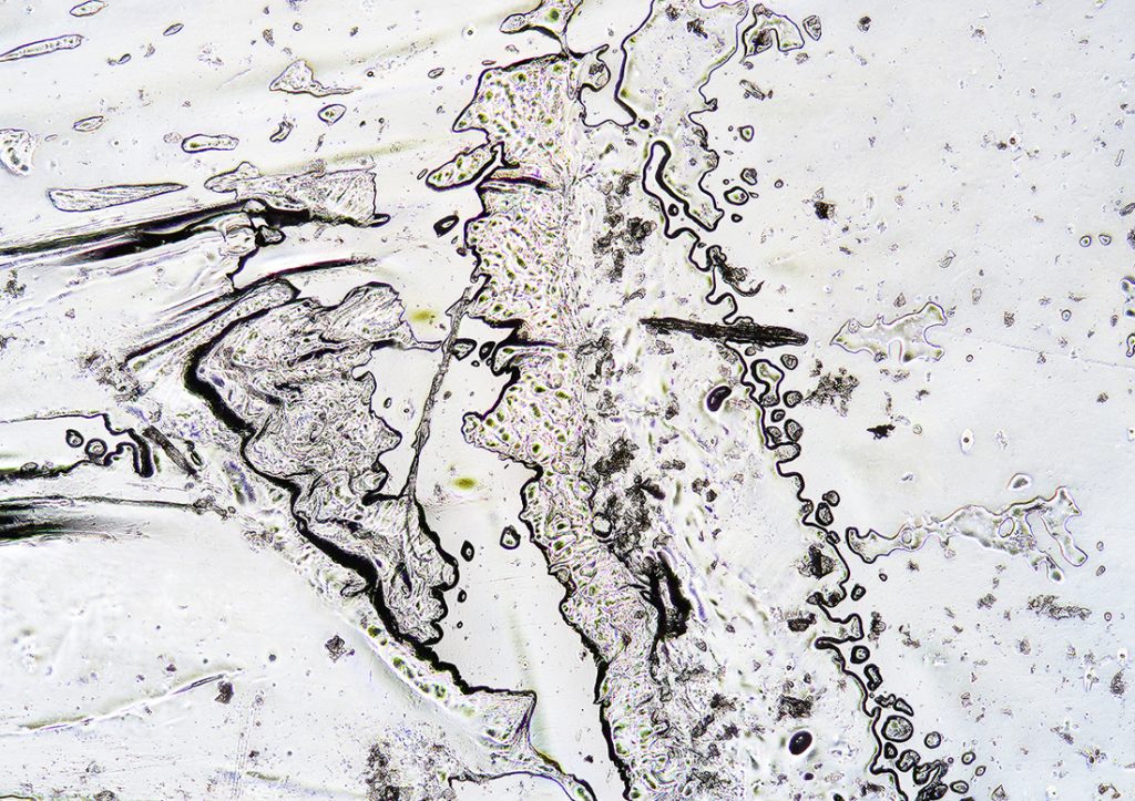 A skin sample viewed through a microscope that looks clear with black outlines and specks of black and yellow. 