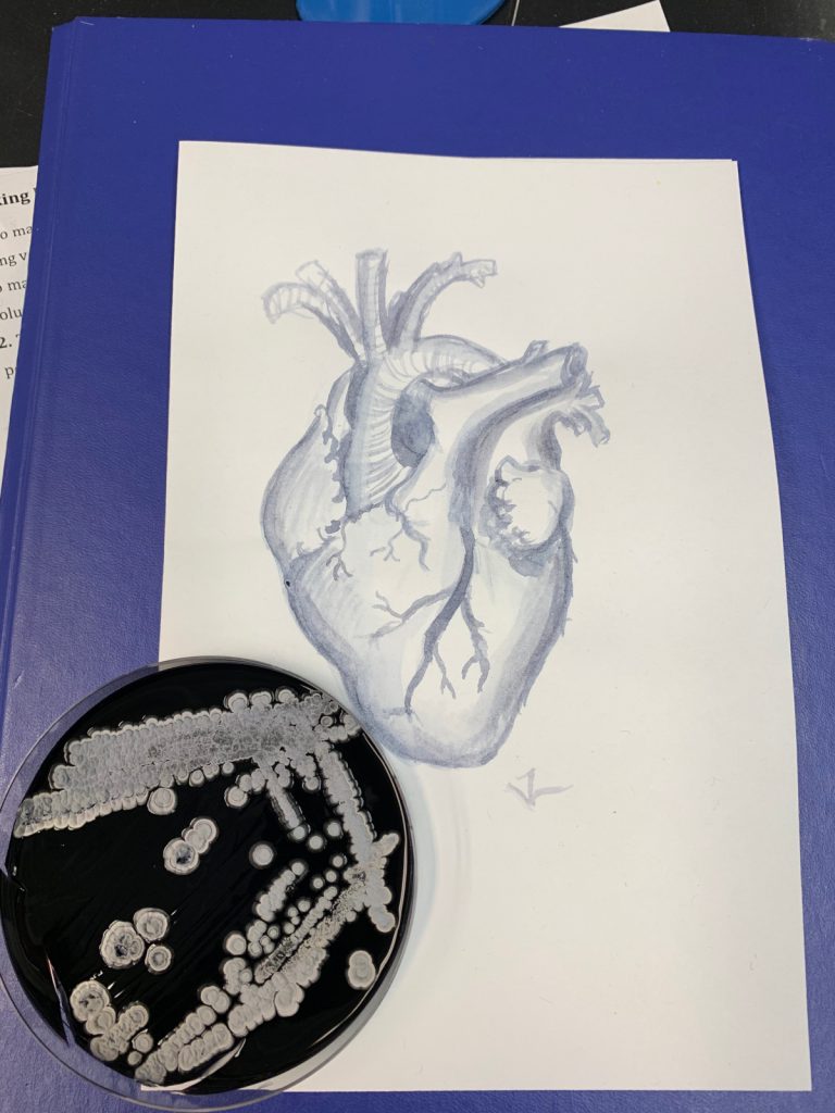 Blue painting of an anatomical heart. Next to it is a Petri dish with blue medium (agar) and white bacterial colonies. 