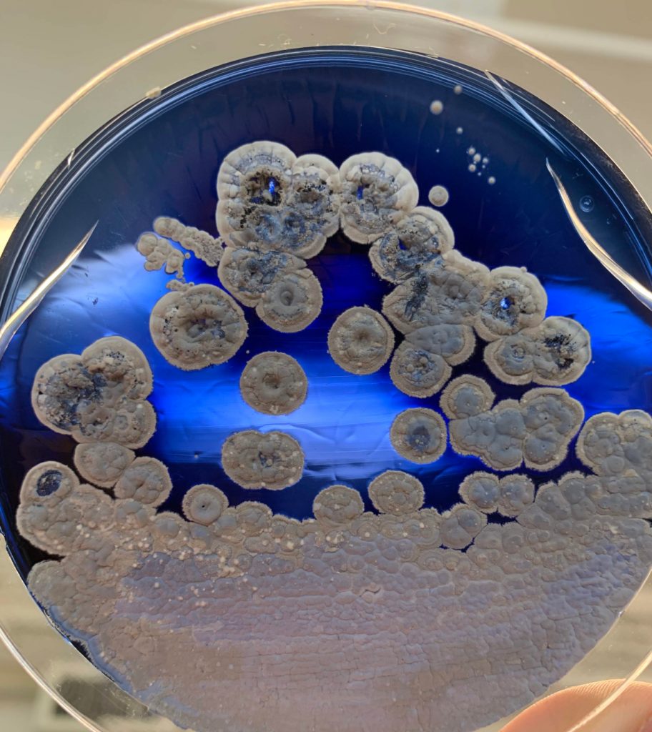 Petri dish with blue agar and white and blue bacterial colonies. It is held up to the light to look like a stained glass window.