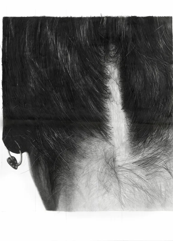 Back of woman's head with hair up to reveal a scar extending from the base of her neck upward. 