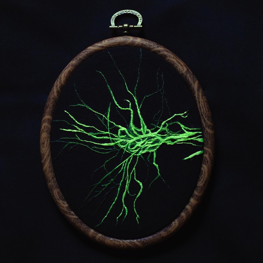 Bundle of intertwining nerves in fluorescent lime green. 