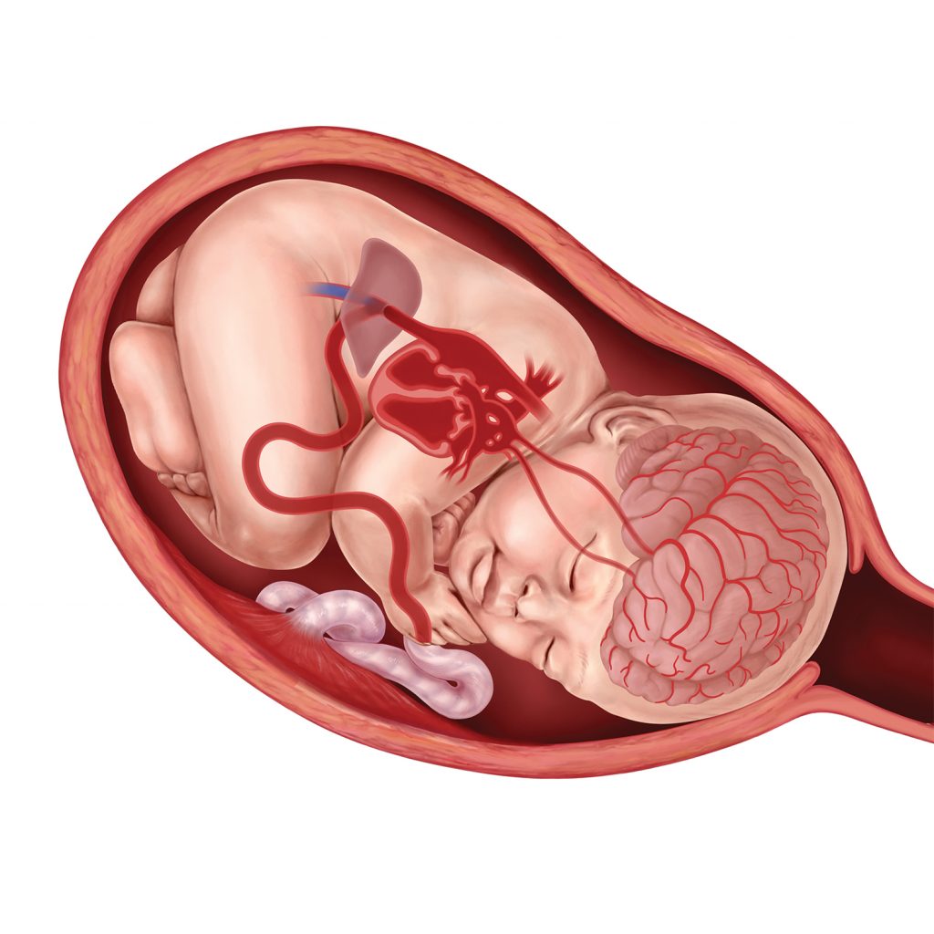 Miller v. Dow: Medical Legal Visualization (2018) by Sarah Crawley. A image of a fetus in the uterus. Medical visualization  