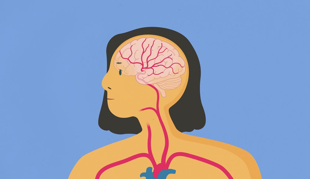 Introduction of Stroke (2019) by Sarah Crawley. An illustration of brain.  