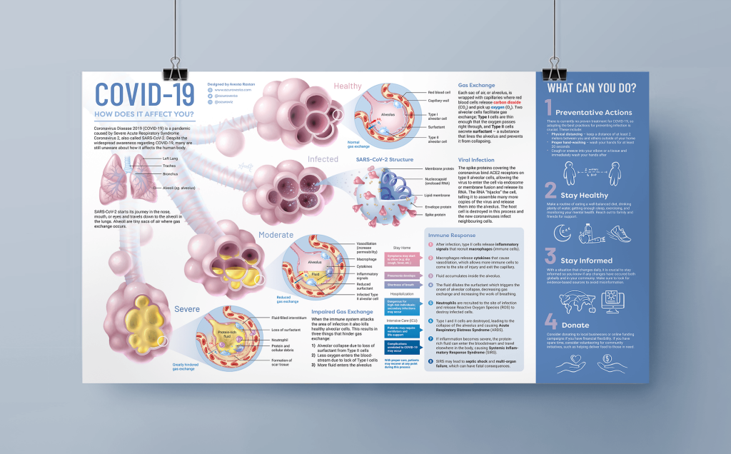 Infographic COVID by Avesta Rastan. A infography about COVID-19. A detailed chart on how it affects a person, preventative actions etc.  