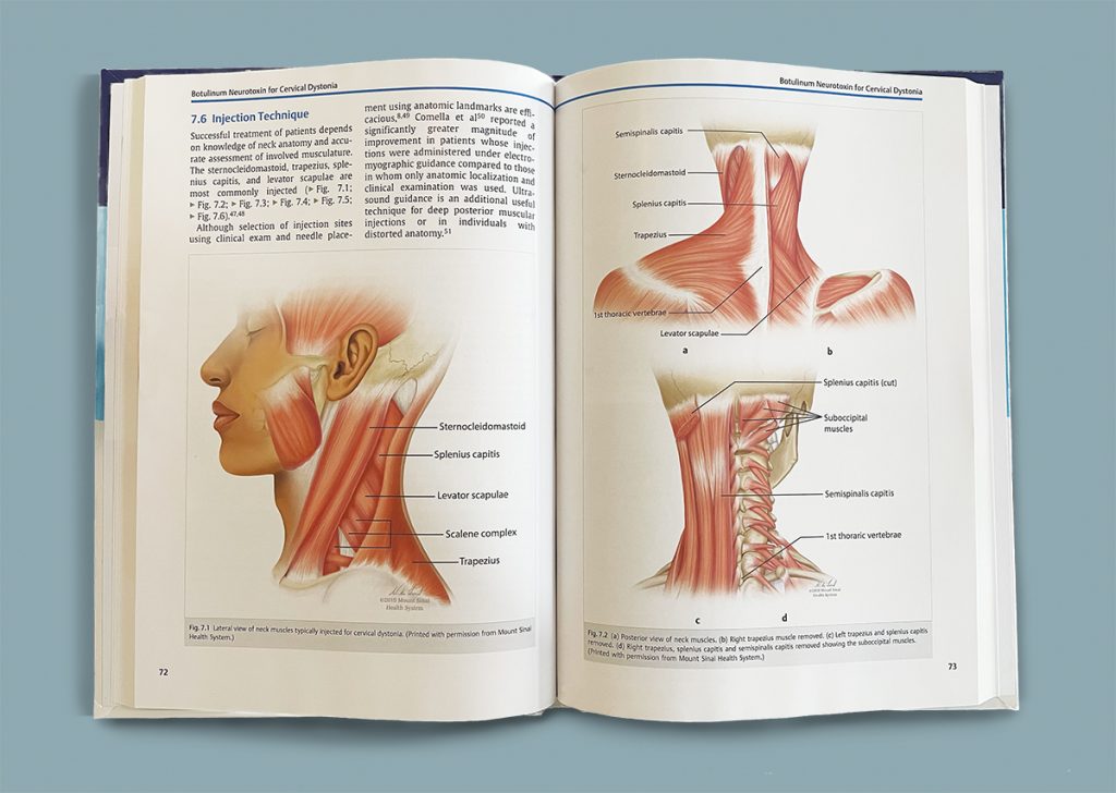 Textbook that's open to a spread showing showing diagrams of different muscles in the neck. 