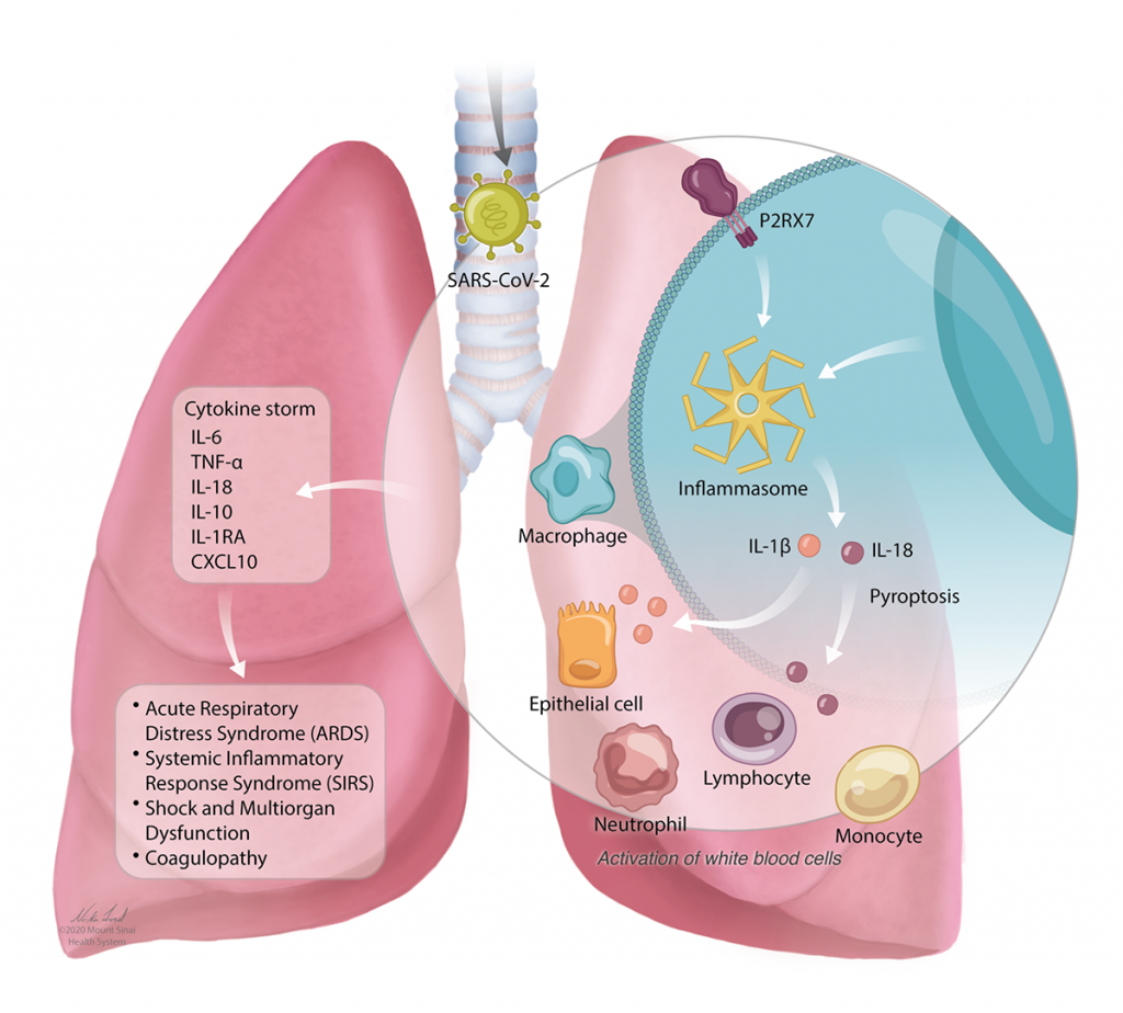 Illustration of lungs showing the reaction of different proteins and cells when SARS-CoV-2 (virus that causes COVID-19) enters the lungs. 