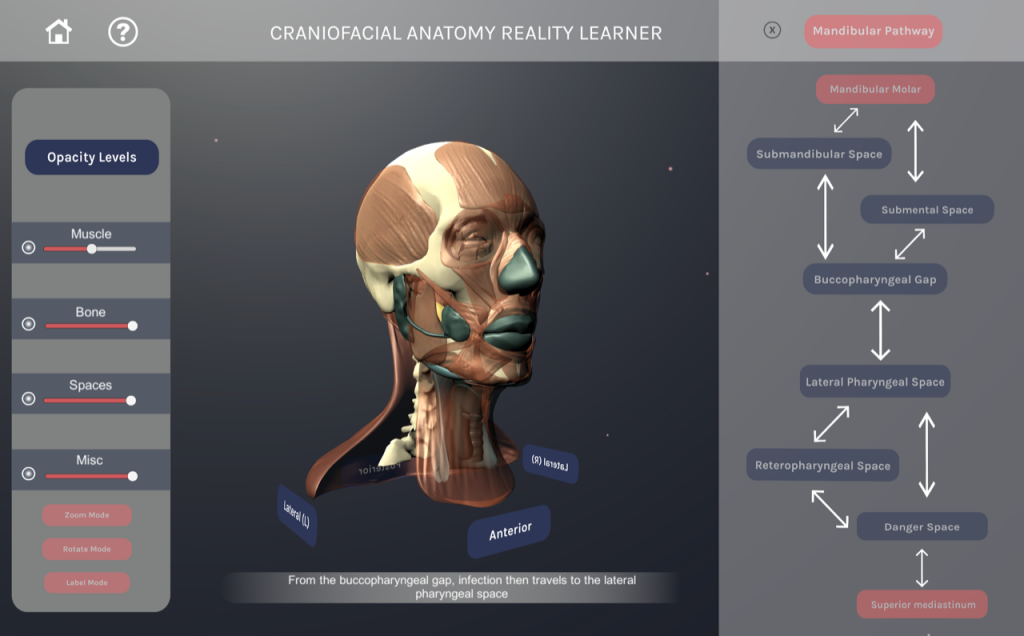 Virtual reality program screen capture showing a head with its muscles exposed, different settings to show what anatomical features are seen, and the different anatomical pathways are listed.