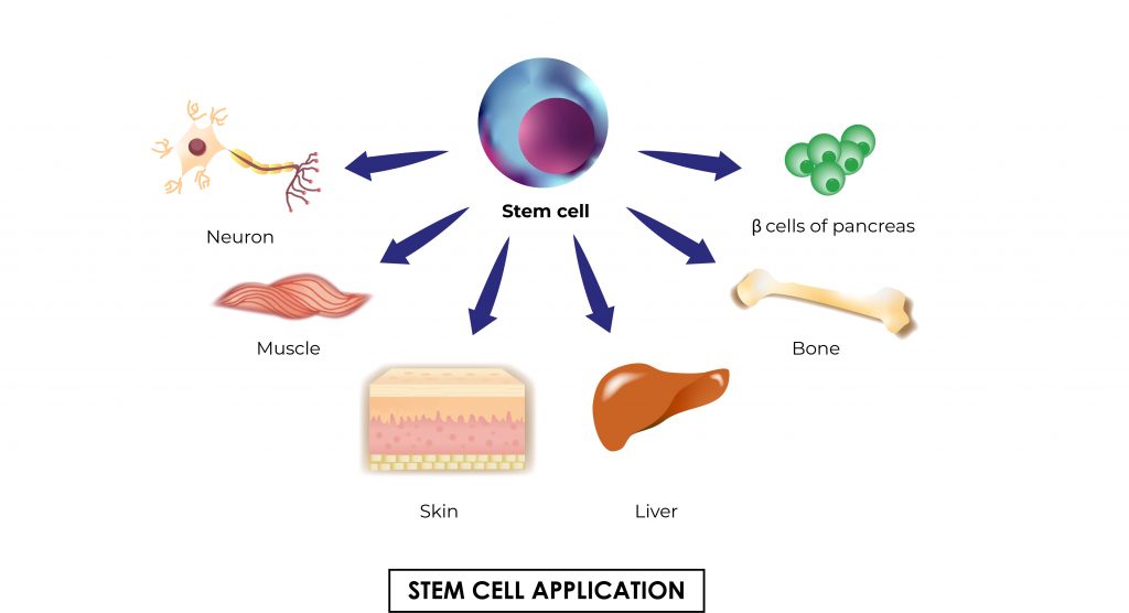 Pictorial representation of stem cell application it shows different how stem cells deviate to other organs by Rutuja Chalke