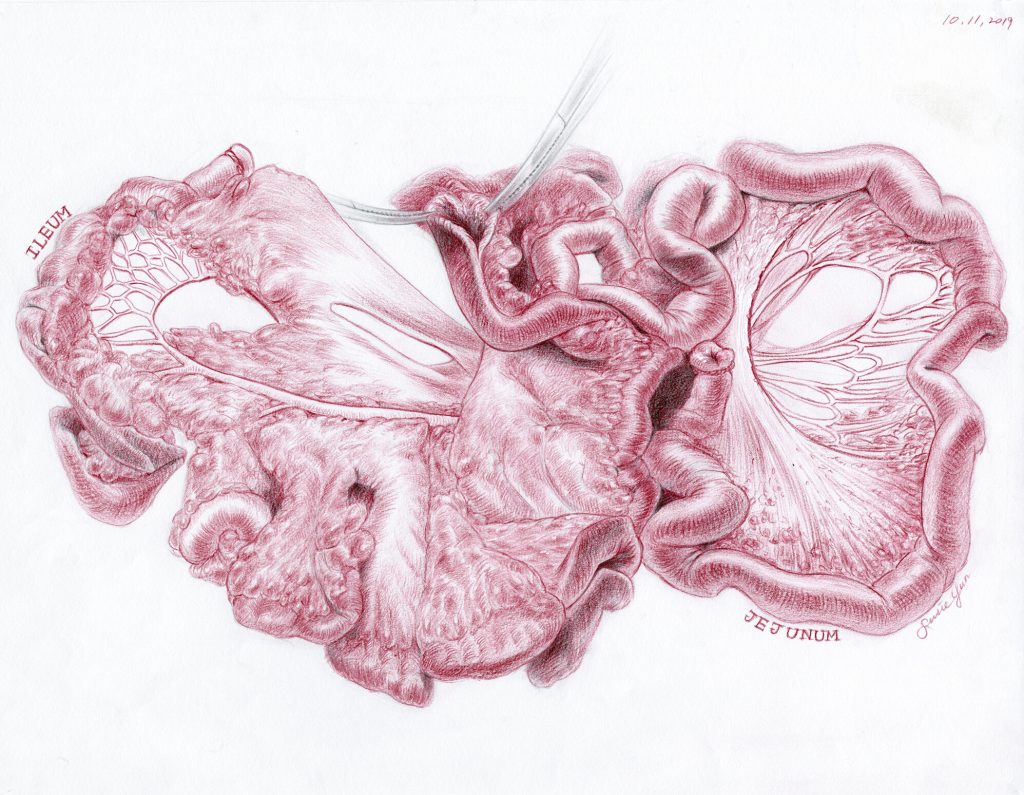 This is an coloured sketch of small intestine. 