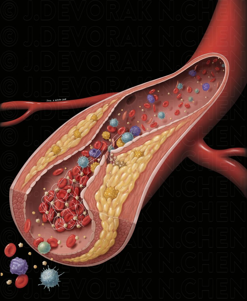 A colour life-like medical illustration of a red tube structure. Inside the structure are small organic-looking purple, blue, green, and yellow objects flowing out of the tube.