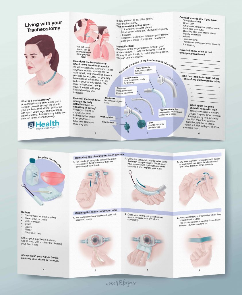 A pamphlet that explains how it is to live with Tracheostomy.