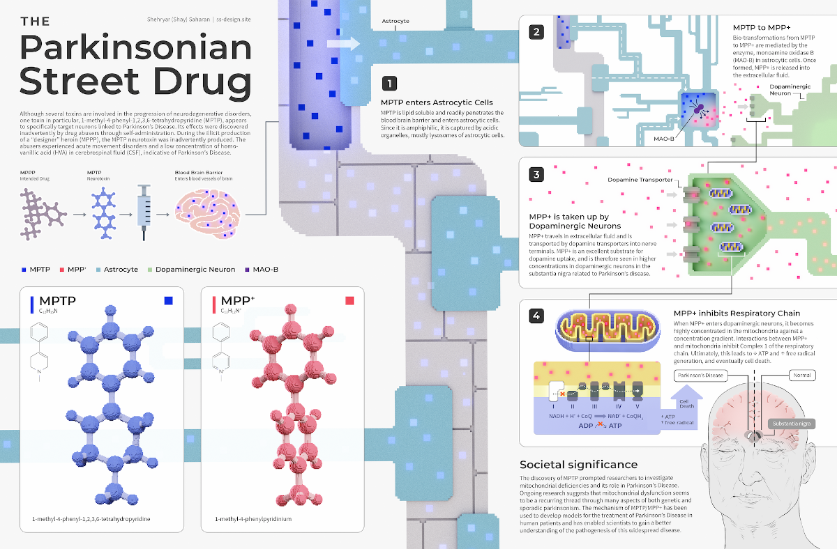 A series of diagrams and illustrations with the title "The Parkinsonian Street Drug" meant to show how the neurotoxin involved in neurodegernative disorders was accidentally produced in "designer" heroin, how it affects the brain, and how it prompted research into mitochondrial deficiencies and its role in Parkinson's disease.