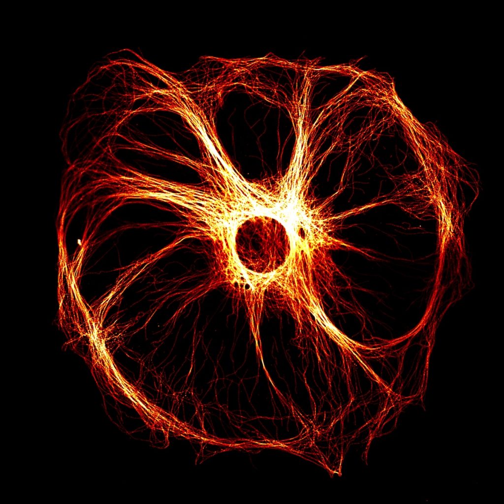 Against a black background, a luminous red, yellow, and orange circular shape with a hole in the centre from which thin strands splay, creating about ten "arms".