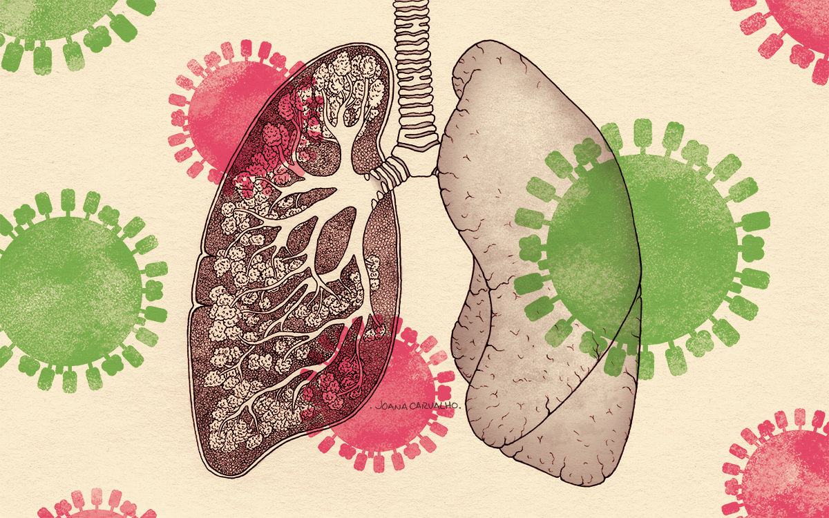 An anatomical illustration of lungs overlaid with colourful coronaviruses